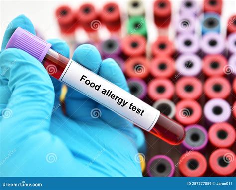 food allergy test philippines|Shinagawa Allergy Test .